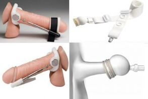 extenseurs pour l'agrandissement du pénis